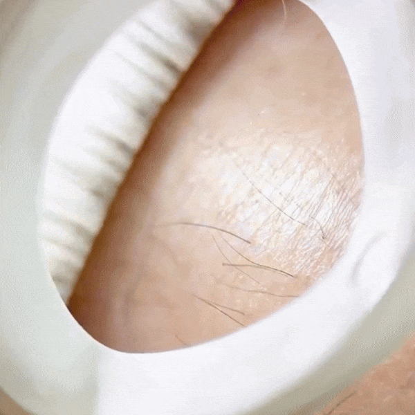 MAXIPACK Epilizer 3-en-1 - SOS Peau parfaite