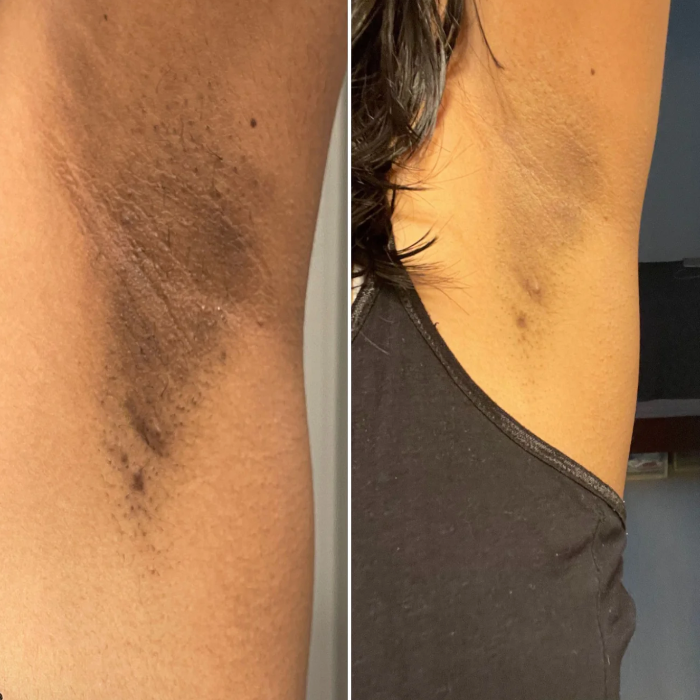 Pack 2-en-1 Epilation Parfaite